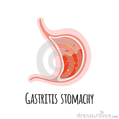 The stomach of a person with gastritis. Gastroenterology. Vector illustration in a flat style. Vector Illustration