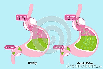 Stomach with sphincter Stock Photo