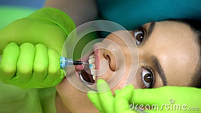 Stomatologist applying blue gel on tooth, cosmetic dentistry, aesthetics Stock Photo