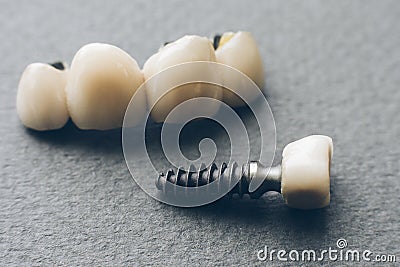 Stomatology healthcare denture dental crown Stock Photo