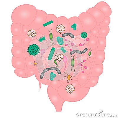 Stop Bacterial overgrowth in small intestine Vector Illustration