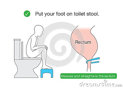 Straightens the rectum while sitting on toilet with small benches. Vector Illustration