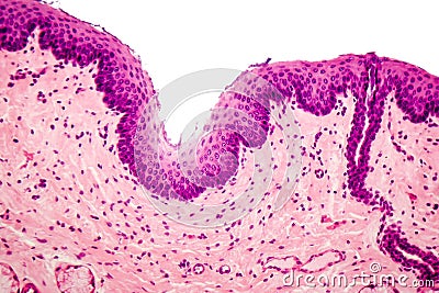 Stratified squamous epithelium Stock Photo