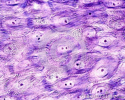 Epidermis. Stratum spinosum. Desmosomes Stock Photo