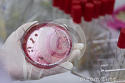 Streak plate for Bacteria culture or identify Bacteria research. Stock Photo