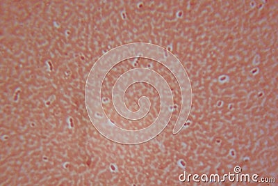 Streptococcus pneumonia Stock Photo