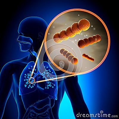 Streptococcus - Spherical Gram-positive bacteria Stock Photo