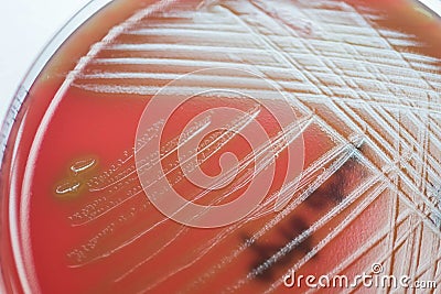 Streptococcus suis; Gram-positive, to Gram-variable, nonmotile, Stock Photo