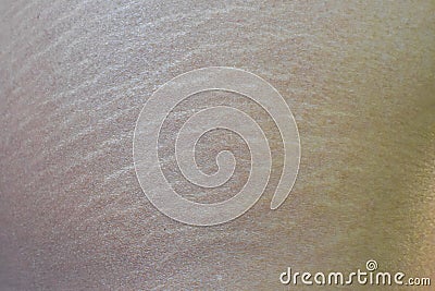 Stretch Marks Stock Photo