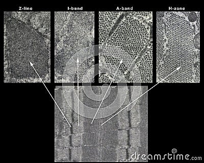 Striated muscle fiber sarcomere Stock Photo