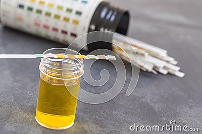 Strip of pH paper resting on specimen, with comparison chart box Stock Photo