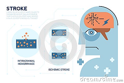 Stroke Brain Disease Vector Illustration