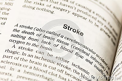 Stroke cerebrovascular accident brain tissue blood flow Stock Photo