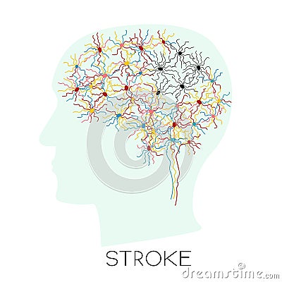 Stroke concept with human head silhouette Vector Illustration