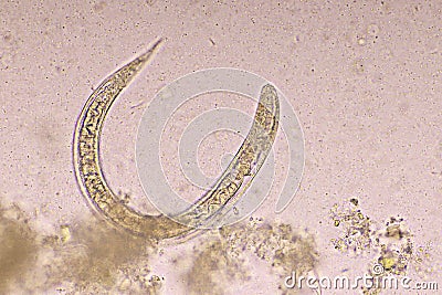 Strongyloides stercoralis or threadworm Stock Photo
