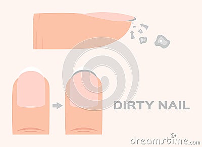 Structure of a dirty Finger Nail . human . anatomy Vector Illustration