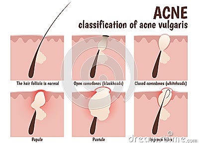 Structure of the hair follicle Vector Illustration