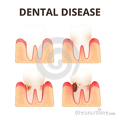 Structure of human teeth Vector Illustration