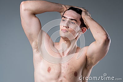 Studio portrait of a young brunette caucasian man on gray background posing. Puberty theme, problem skin, teen acne Stock Photo