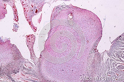 Study Histology of human, tissue bone under the microscopic. Stock Photo