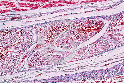 Study Histology of human, tissue bone under the microscopic. Stock Photo