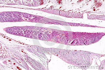 Study Histology of human, tissue bone under the microscopic. Stock Photo