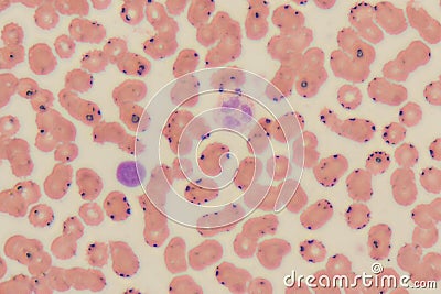 Study Of White Blood Cells Are The Cells Of The Immune System Under The ...