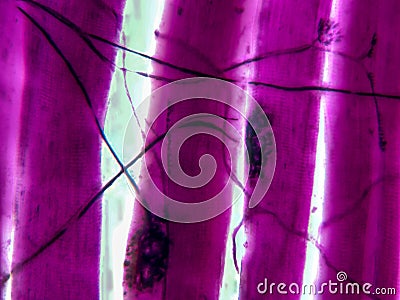 The Connection Between Nerves and Muscles: Motor Unit Synapse in Stunning Detail Stock Photo