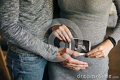 Stylish pregnant couple holding ultrasound scan of baby on baby bump. Healthy young parents holding in hands on belly photo of Stock Photo