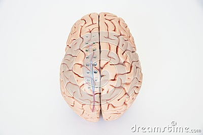 Subdural grid electrode for brain waves recording or electroencephalography on the brain model Stock Photo