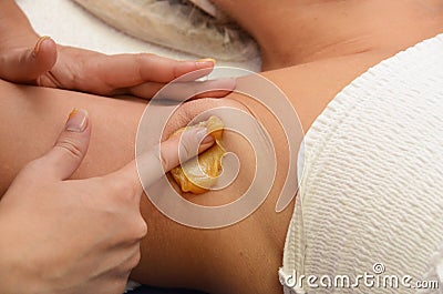 Sugaring epilation Stock Photo