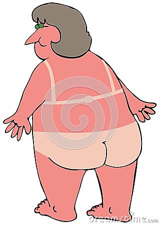 Sunburned Woman Cartoon Illustration