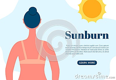 Sunburned woman back view cartoon character. Sun tanning danger concept. Skin redness flat vector illustration Vector Illustration