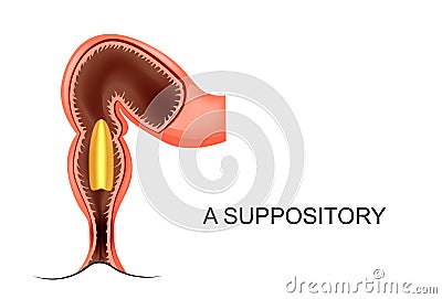 A suppository in the anus Vector Illustration
