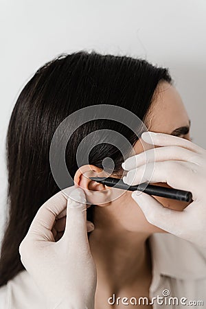 Surgeon doctor marking girl ear before otoplasty cosmetic surgery. Otoplasty markup for surgical reshaping of the pinna Stock Photo