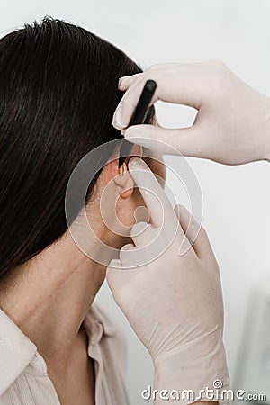 Surgeon draw marking on ear before otoplasty cosmetic surgery. Otoplasty markup before ear surgery. Otoplasty mark-up Stock Photo