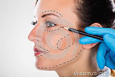 Surgeon Drawing Correction Lines On Young Woman Face Stock Photo