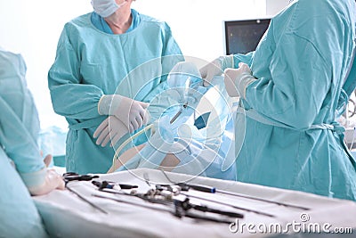 Surgeons perform laparoscopic surgery. Laparoscopic surgery. Operation under general anesthesia. Modern surgery.Life Stock Photo