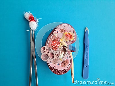 Surgery of adrenal glands and anatomy of kidney Stock Photo