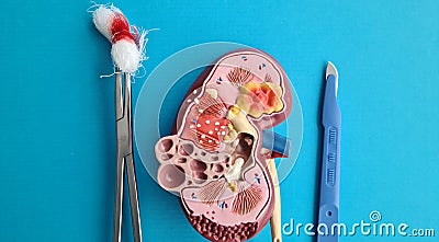 Surgery of adrenal glands and anatomy of kidney Stock Photo