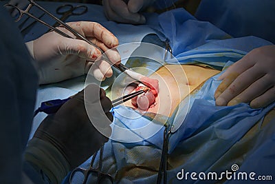 Surgical Area During The Surgery Stock Photo