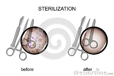 Surgical instruments before and after sterilization Vector Illustration