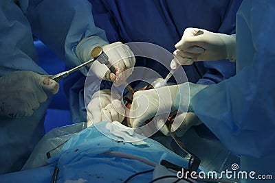 Surgical Mallet In Use Stock Photo
