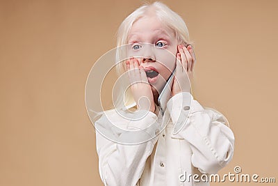 Surprised albino child with phone Stock Photo