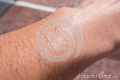 Sweat male arm hair skin pore hot day summer Stock Photo