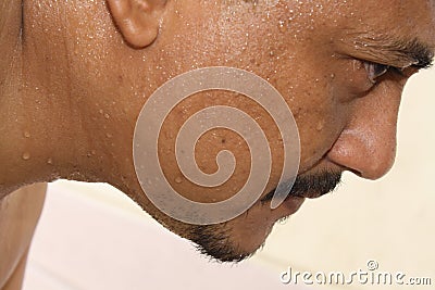 Sweating face Stock Photo