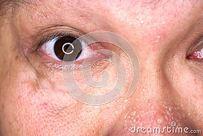 Sweaty face and eye Stock Photo