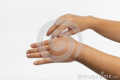 Swollen hand from allergic of insect stings. Skin allergic care Stock Photo