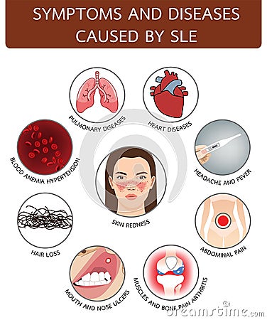 Symptoms and diseases caused by SLE, info graphic illustration on white background Cartoon Illustration