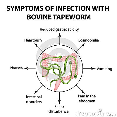 Symptoms of infection are bovine tapeworm Vector Illustration